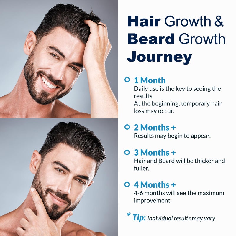 FUZYAT 5% Minoxidil Spray for Men and Women, Minoxidil for Women Hair Growth, Minoxidil for Men Hair Growth Spray 4PCS. - Image 5