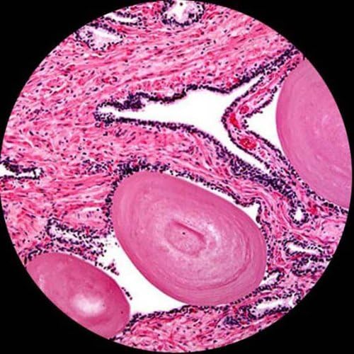 AmScope AmScope 40X1000X Student Biological Compound Monocular Microscope w Metal Framework Optical Glass Lenses Mechanical Stage Coarse  Fine Focus  - Image 4