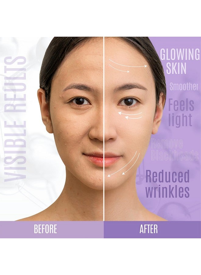 ديرماكسجين سيروم ديرماكسجين ليفت آند فيرم ٣٠٪ ببتيد - ماتريكسيل ٣٠٠٠، فيتامين سي وهـ + حمض الهيالورونيك + الصبار | مُعزز للكولاجين، مُشدّ للبشرة ومُكافح للشيخوخة - (٤ أونصة سائلة) لجميع أنواع البشرة - Image 5