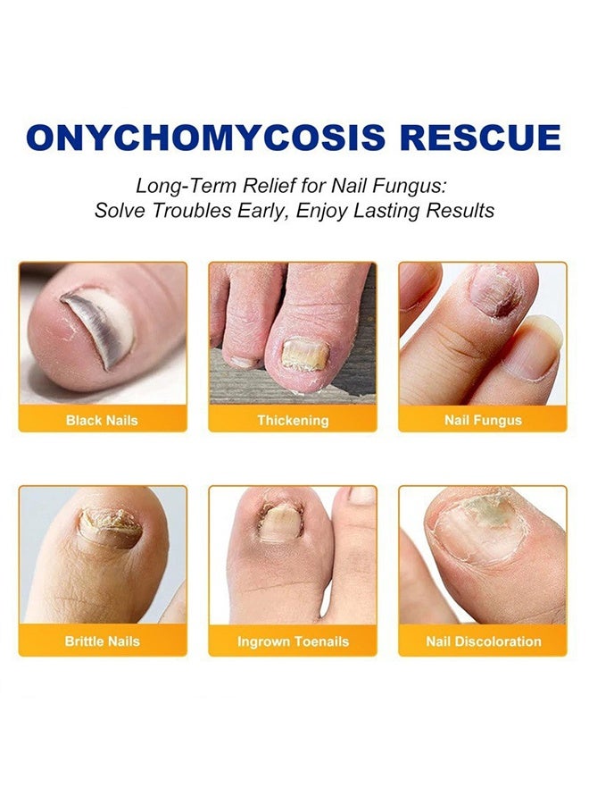 Sefudun Fungal Nail Patches,Toenail Fungus Treatment Extra Strength - Toe Nail Fungus Treatments for Men and Women, Overnight Renewal Nail Repair Patches,32 Pcs - Image 4