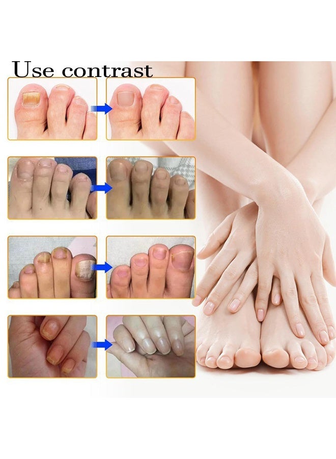 Sefudun Fungal Nail Patches,Toenail Fungus Treatment Extra Strength - Toe Nail Fungus Treatments for Men and Women, Overnight Renewal Nail Repair Patches,32 Pcs - Image 2