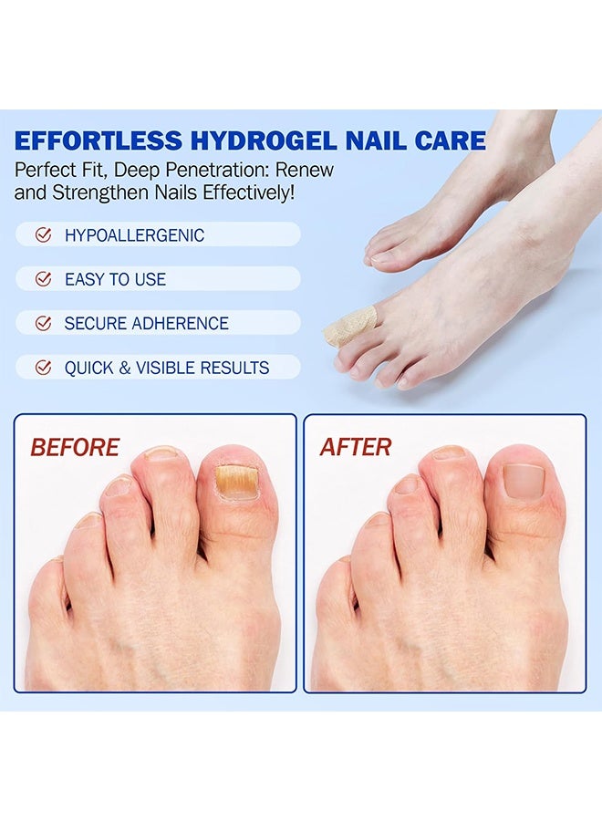 Sefudun Fungal Nail Patches,Toenail Fungus Treatment Extra Strength - Toe Nail Fungus Treatments for Men and Women, Overnight Renewal Nail Repair Patches,32 Pcs - Image 3
