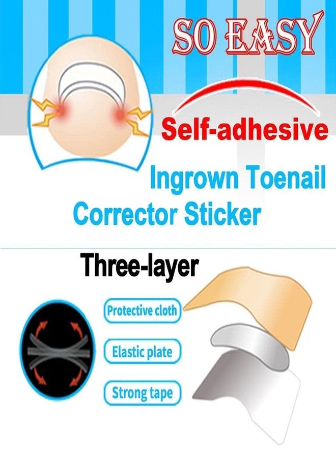 SNAPCOM Toe nail Tool | Nail Treatment Corrector Sticker | Treatment Correction Pedicure White | Strong Adhesion Toenail Corrector Strips | Breathable Elastic for Correction (50 pcs) - Image 5