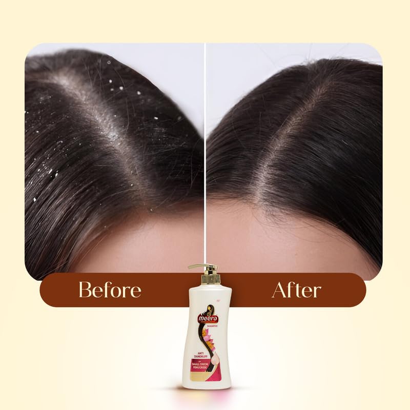 Meera Anti Dandruff Shampoo, With Goodness Of Small Onion and Fenugreek, For Men And Women, 650ml. - Image 4
