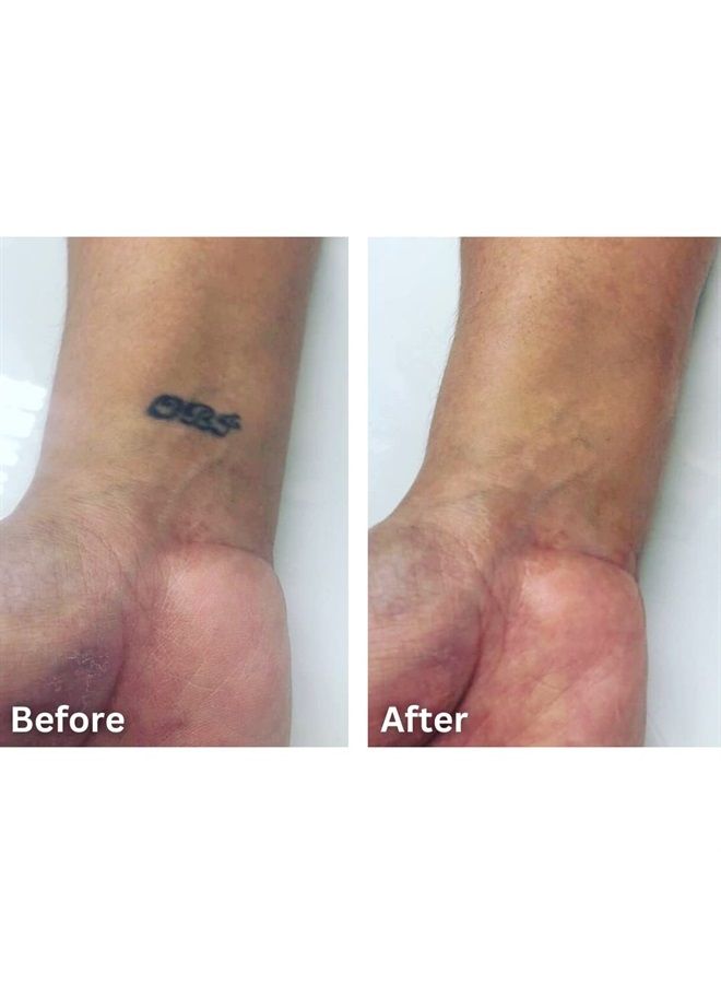 dermaflage كريم تصحيح الوشم - تغطية كاملة - مقاوم للماء، مقاوم للبقع والعرق، لوحة كريم تصحيح الجسم المحترفة SFX - 3 درجات لونية للندبات وحب الشباب (تان) - Image 3