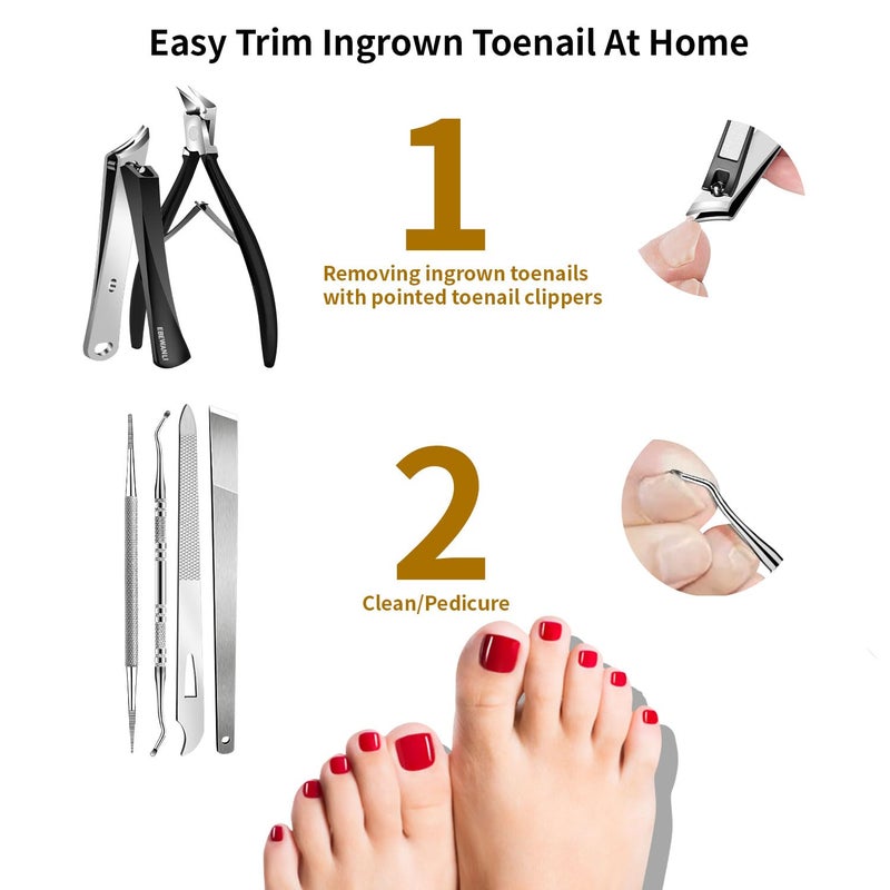 EBEWANLI Ingrown Toenail Removal Kit, 6PCS Stainless Steel Toe Nail Kit, Straight Edge Oblique and Curved Slanted Nail Clippers Cutters for Ingrown Nails, Professional Pedicure Tool at Home - Image 2