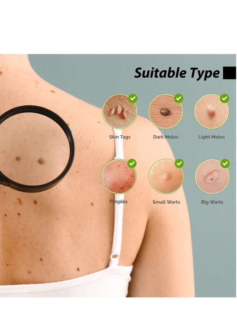 EELHOE skin mole removal dont be embarrassed by skin tags make your skin smooth 10ml - Image 2