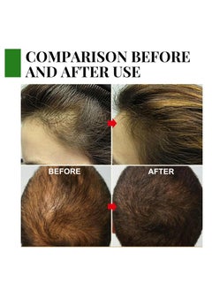 EELHOE 2 Pcs Rosemary Essential Oil for Hair Growth Pure Organic Rosemary Oil for Dry Damaged Hair Scalp Oil Premium Quality Oil Hair Loss  Treatment Oil Hair Growth Serum for Men and Women (30mlx2)  - Image 3