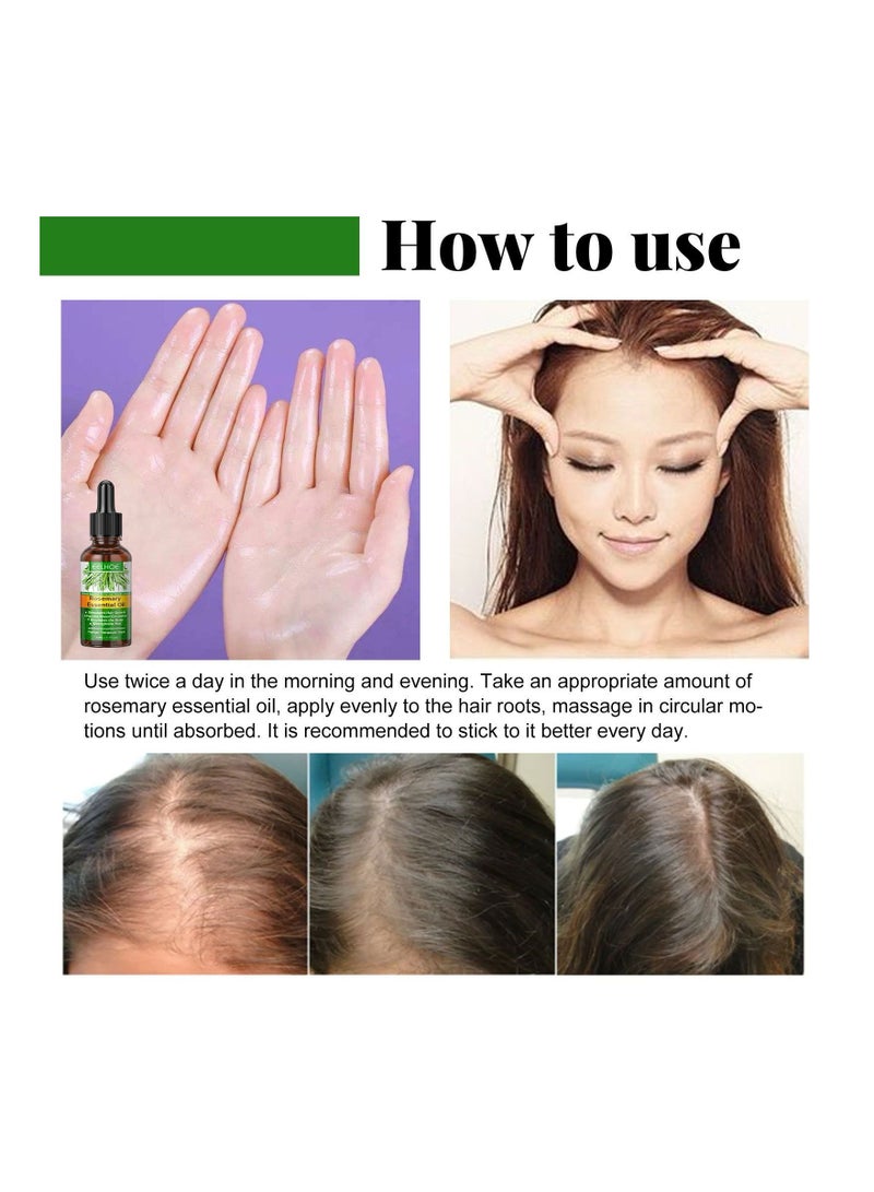 EELHOE Pure Rosemary Essential Oil Hair Regrowth 30ml - Image 4