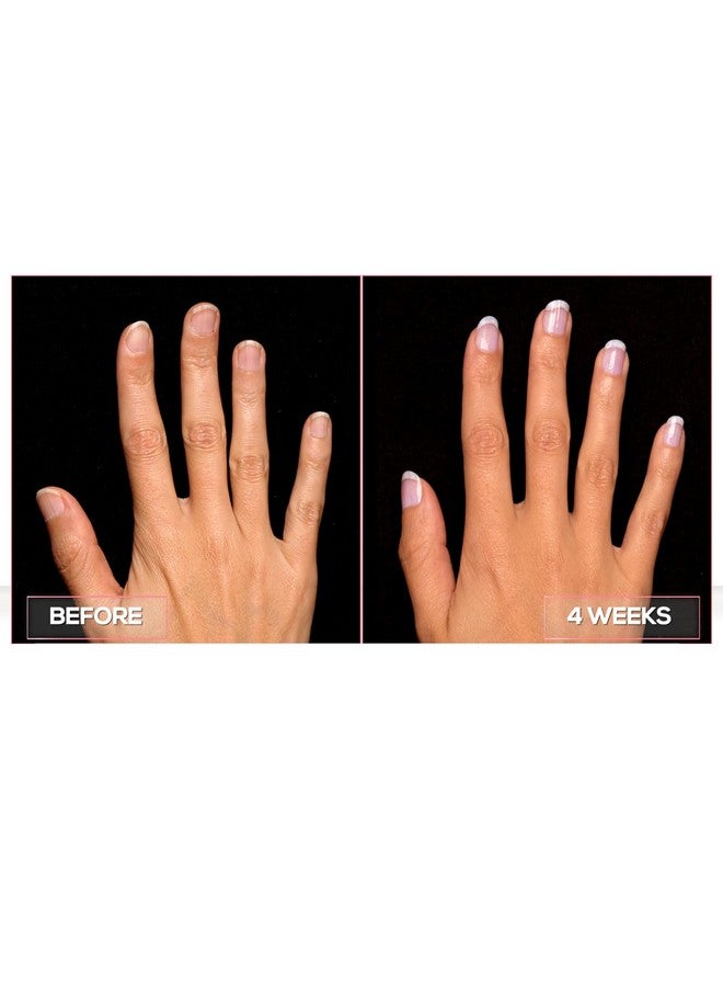 Perfect Formula Nail Collection The Perfect Keratin Nail Treatment Manicure A Suit Of Armor For Your Nails 4 Pieces. - Image 4