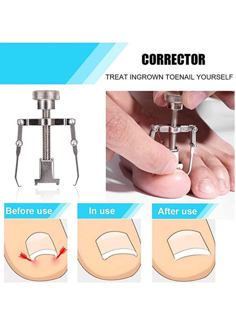 NQOOH - Professional Stainless Steel Nail Clipper Set for Ingrown Toenails and Thick Fingers, Manicure and Pedicure Tools - Image 1