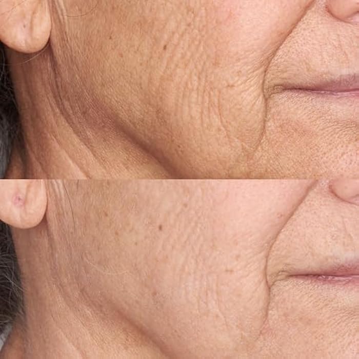 Perricone MD High Potency Face Finishing & Firming Moisturizer Broad Spectrum SPF 30 - Image 3