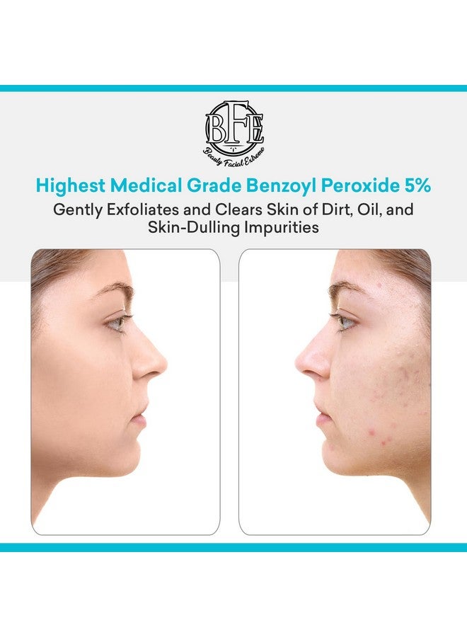 بيوتي فيشال إكستريم علاج حب الشباب بغسول الوجه مع بنزويل بيروكسيد ٥٪ - تخلص من بقع حب الشباب عند التلامس مع البثور الكيسية، والبشرة الدهنية، والمسام المسدودة، والرؤوس السوداء والبيضاء، والبثور. احصل على بشرة صافية. - Image 5