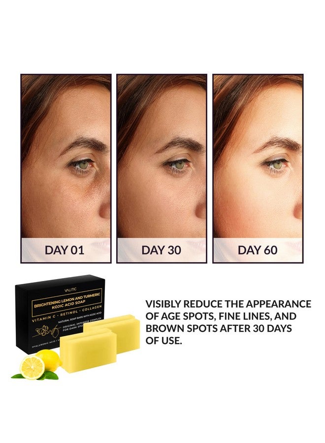 VALITIC Brightening Lemon & Turmeric Kojic Acid Soap With Vitamin C, Retinol, Collagen - Original Japanese Complex Infused With Hyaluronic Acid, Vitamin E, Shea Butter, Castile Olive Oil (4 Pack) - Image 1