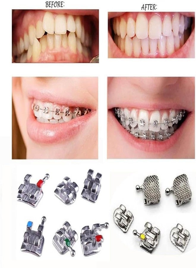 DentalSmile 3 Kits(60) Dental Bracekts MIM Orthodontics MBT Mini 022 with Hooks 345 - Image 2