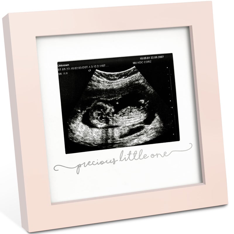 KeaBabies Baby Sonogram Picture Frame - Modern Ultrasound Picture Frames for Mom to Be, First Pregnancy Gifts for Expecting Mom & First Time Dad, Baby Gender Reveal Gifts (Petal Pink) - Image 1