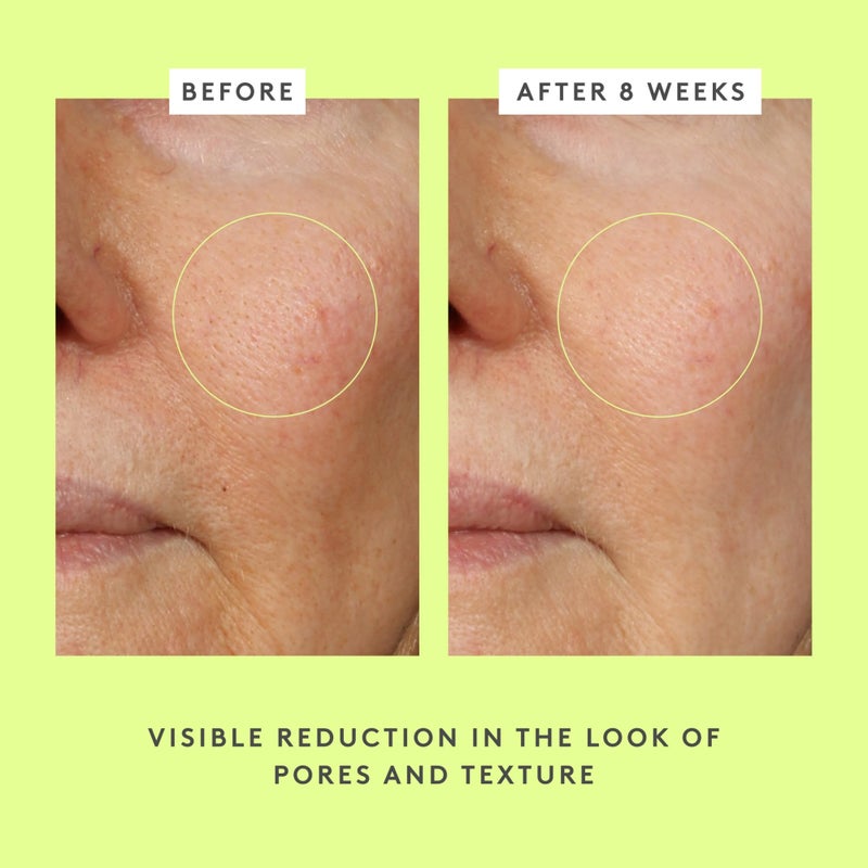 Drunk Elephant T.L.C. Framboos Glycolic Serum - 30 ml/1 fl oz - Exfoliating AHA Serum - Clean Clinical Skincare - Cruelty-Free - Dermatologist-Tested - Free of Essential Oils, Silicones, and Fragrance - Image 3