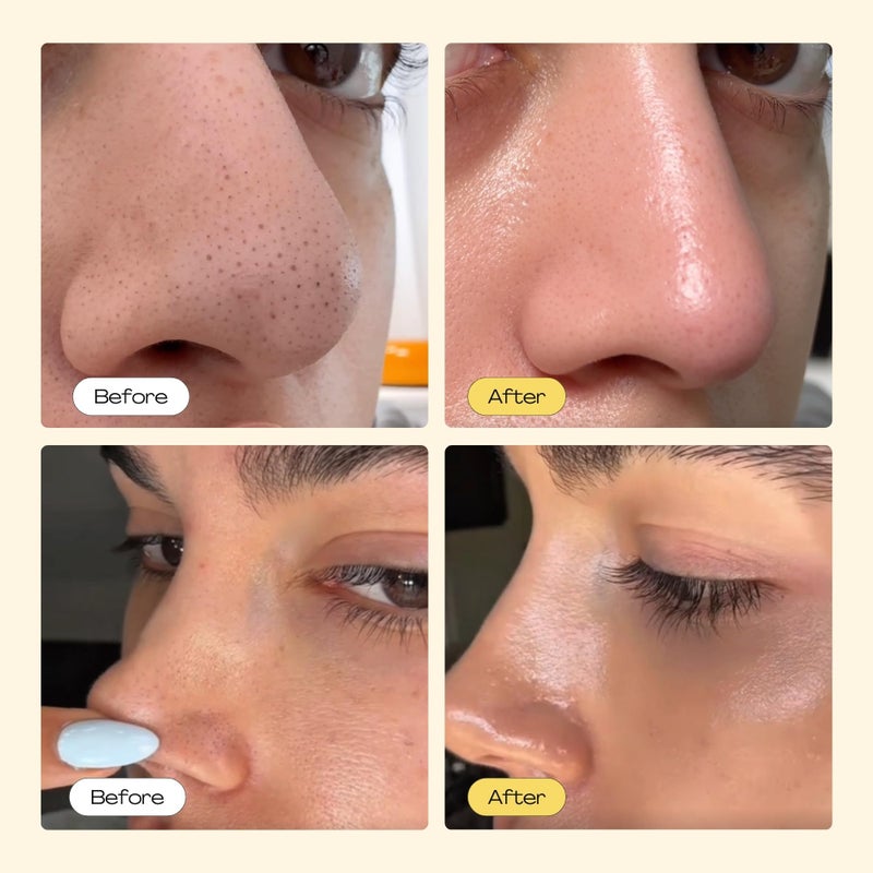 Luelle - Pore Strips, Deep Cleansing Patch System, Blackhead Remover, Nose Plants Strips with 100 PCS, Blackhead Remover Peel off Mask Face & Nose - Image 2