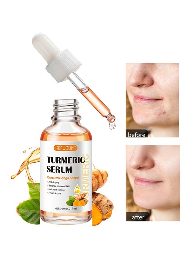 Sefudun Turmeric Serum,Suitable for Moisturize and Whiten Skin on Face and Remove Macula Anti Aging,Balance Uneven Skin,Natural Turmeric Serum 30ml - Image 1
