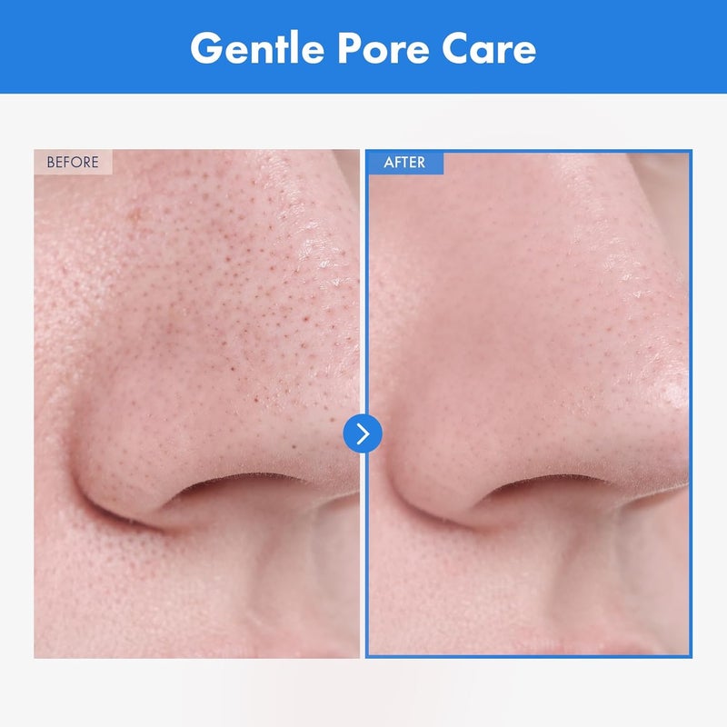NATUREKIND زيت تنظيف الوجه العميق NATUREKIND AHA مع زيت الجوجوبا وزيت شجرة الشاي و PHA و Centella Asiatica، مزيل الرؤوس السوداء الكوري، منظف المسام ومزيل الزهم، 145 مل، 4.9 أونصة سائلة - Image 2