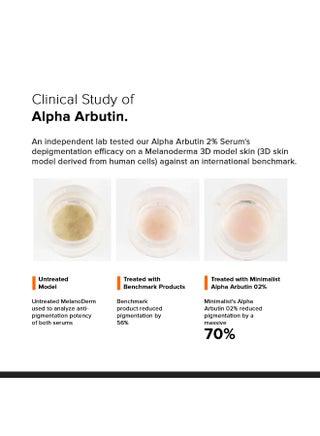 2% Alpha Arbutin Serum for Pigmentation And Dark Spots Removal | Anti-pigmentation Face Serum with Hyaluronic Acid to Remove Blemishes, Acne Marks And Tanning - view 4