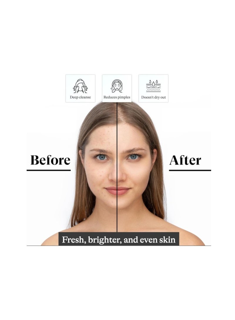 Arogya Activated Charcoal Soap 100g – Deep Cleansing Ayurvedic Bar for Detoxified, Clear & Oil-Free Skin - Image 5
