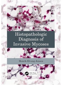 Histopathologic Diagnosis of Invasive Mycoses 