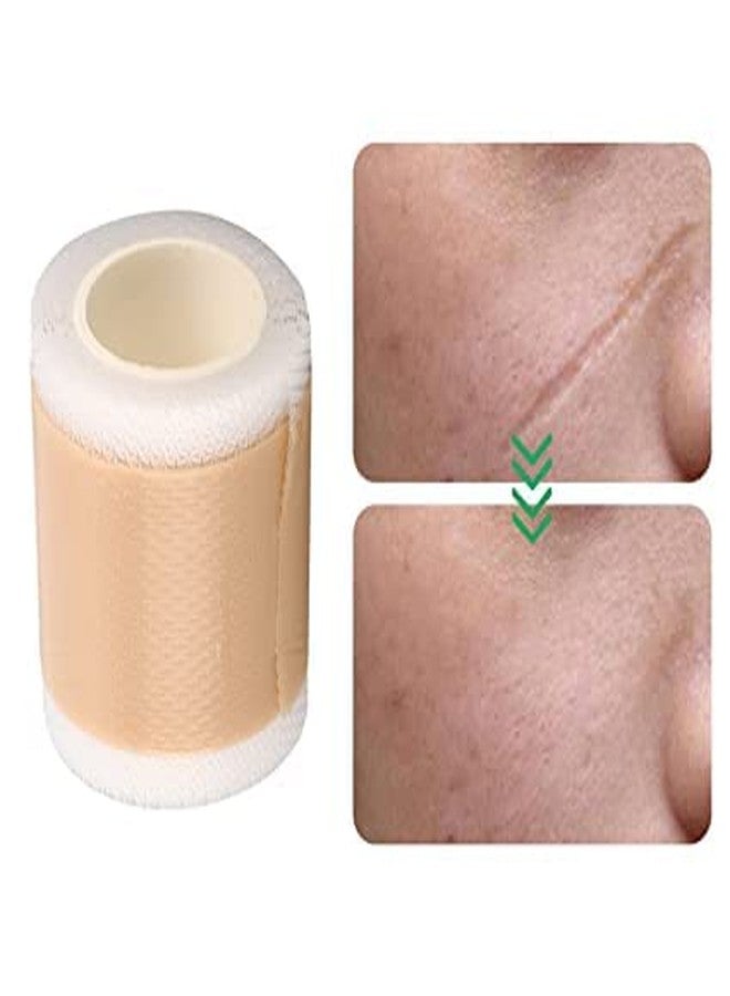 Mezco Reusable Scar Removal Tapes Improve C-Section Burns Surgical Keloid | Scars Remover Silicone Gel Long Strips Tape Roll for Injuries Acne (Skin) (Pack Of 1) - Image 1