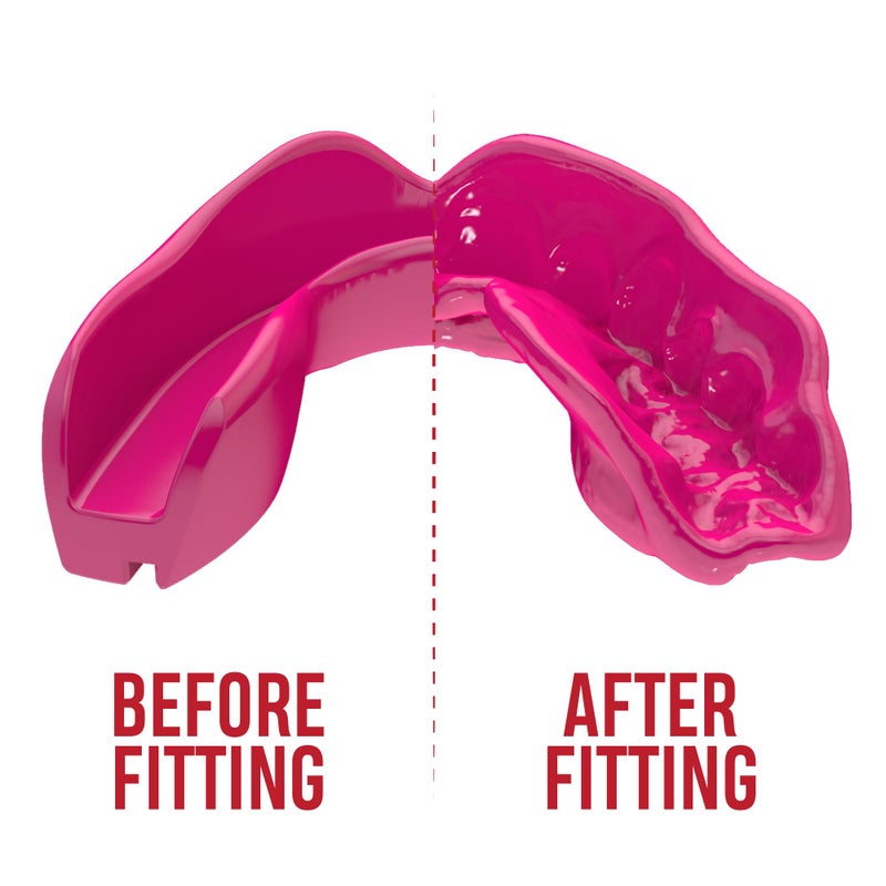 Safejawz Mouthguard Slim Fit  Adults And Junior Mouth Guard With Case For Boxing  Basketball  Lacrosse  Football  Mma  Martial Arts  Hockey And All Contact Sports (Pink) - Image 4