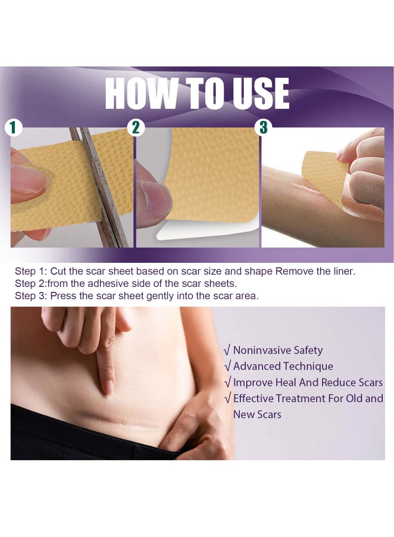 EELHOE Silicone Scar Repair Patch  - Image 3