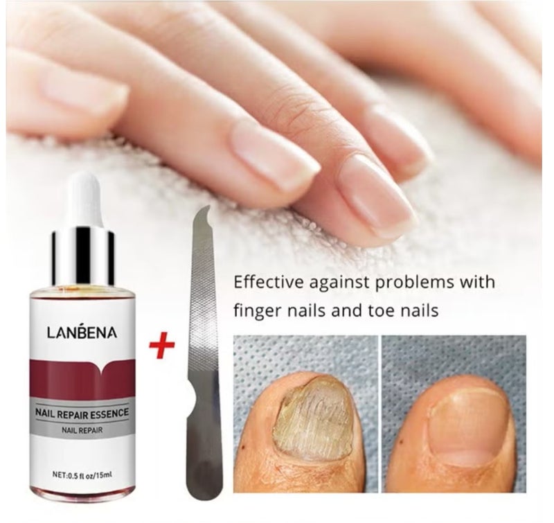 LANBENA Nail Repair Essence, Nail repair, repairs and renews damaged, broken, cracked and discolored nails (15ml) - Image 3