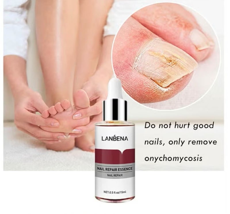 LANBENA Nail Repair Essence, Nail repair, repairs and renews damaged, broken, cracked and discolored nails (15ml) - Image 4