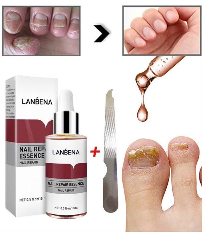 LANBENA Nail Repair Essence, Nail repair, repairs and renews damaged, broken, cracked and discolored nails (15ml) - Image 1
