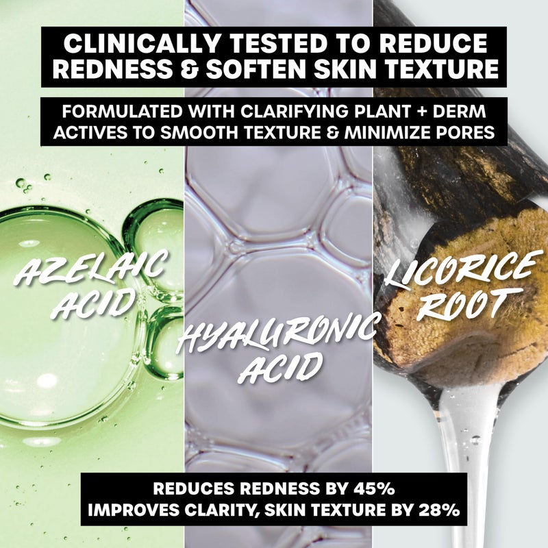 THAYERS Let's Be Clear Water Face Cream, Moisturizer with Azelaic Acid and Hyaluronic Acid, Skin Care for Combination to Oily Skin, 2.5 Oz - Image 4