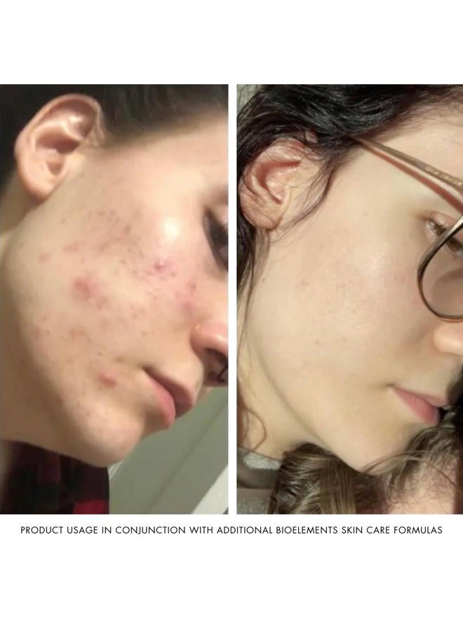 Bioelements Kerafole - 2.5 fl oz - Deep-Purging Facial Mask for Fresh, Radiant Skin - Vegan, Gluten Free - Never Tested on Animals - Image 5