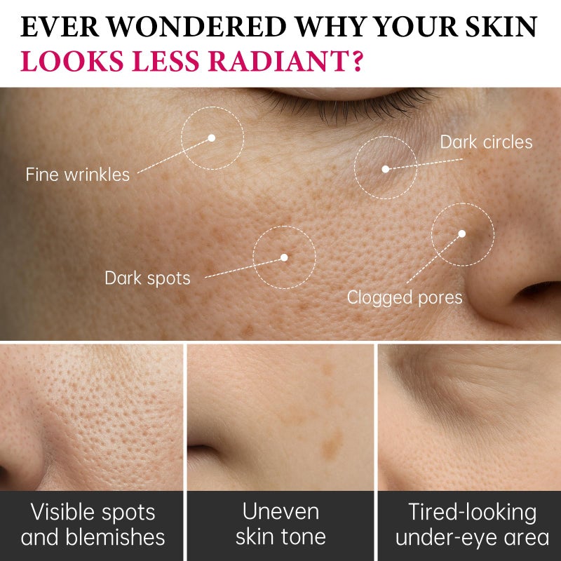 EELHOE Arbutin 7% + Tranexamic Acid 4% Cream, 70,000ppm Arbutin & 40,000ppm TXA,Moisturizing, Hydrating, Even Skin Tone,Reduces Dark Spots & Pigmentation, 1.76 fl.oz (1) - Image 3