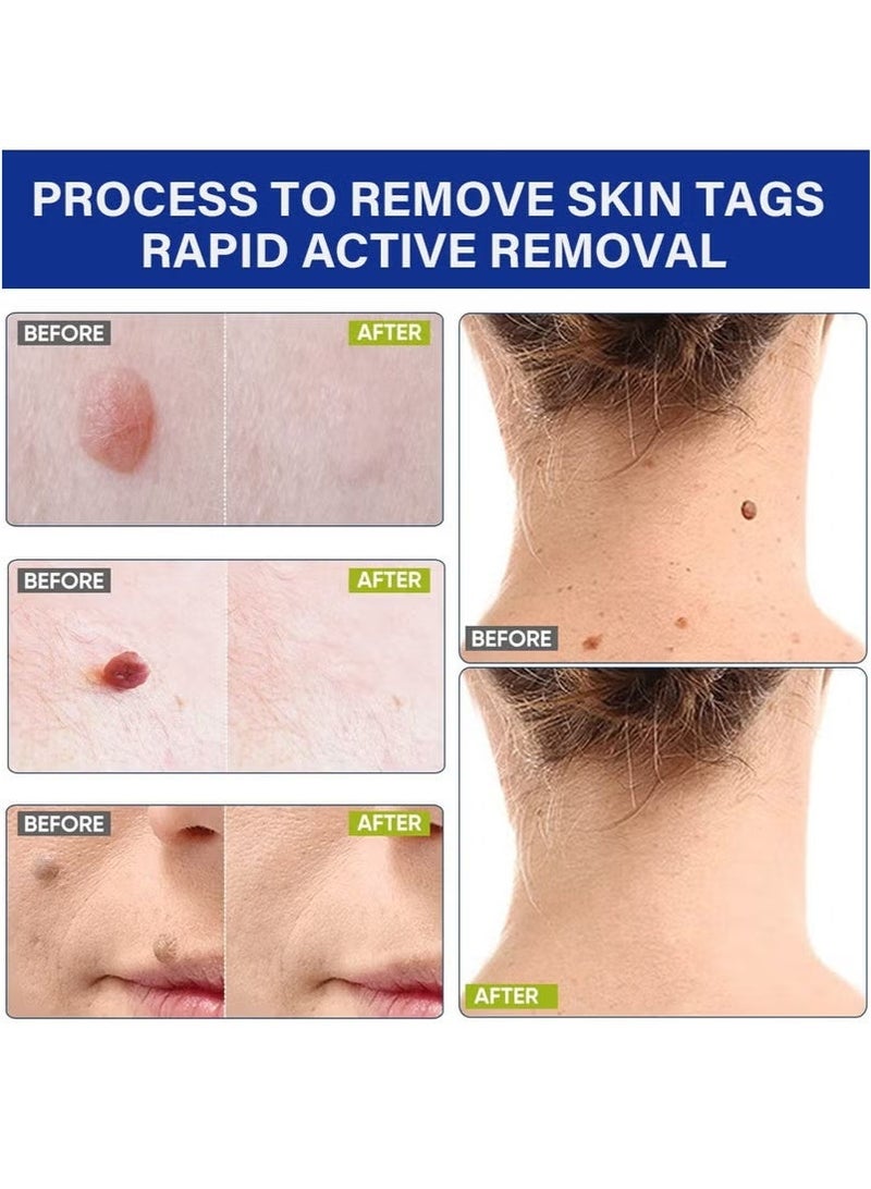 Sumifun Wart Removal Patch, One-Step Invisible Wart Removal Patch, Fast-Acting Wart Solution Freezing Wart Removal, Plantar Warts, Common Warts, Flat Warts 144 Patch/Box - Image 5