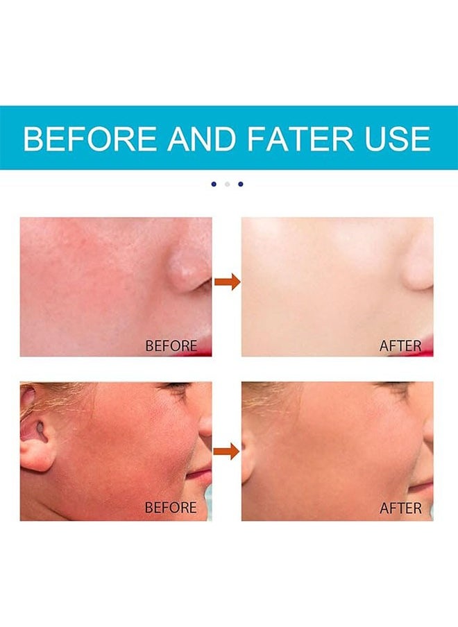 Biore UV Watery Essence SPF 50 + PA ++++ Sunscreen 50ml, Aqua Rich Watery Sunscreen, Watery Essence Sunscreen, Helps Protect Your Face from UV Rays and Moisturizes  - Image 4