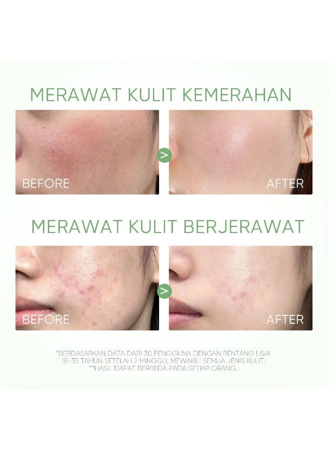 SKINTIFIC Mugwort & Alaska Volcano Clay Mask Sticks – Anti-Inflammatory, Deep Pore Cleansing & Blackhead Removal (2 x 40g) - Image 4