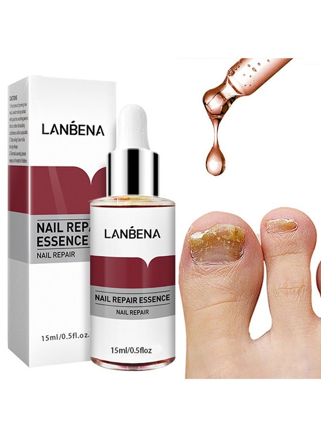 LANBENA Nail Repair Essence Serum, Nail repair, repairs and renews damaged, broken, cracked and discolored nails (15ml) - Image 1