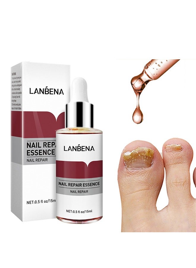 LANBENA Nail Repair Essence Serum, Nail repair, repairs and renews damaged, broken, cracked and discolored nails (15ml)  - Image 1