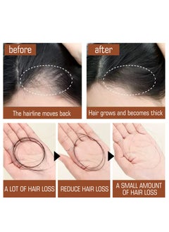EELHOE Batana Oil for Hair Growth Healthier Thicker Fuller Hair, Batana oil, Batana Oil for Hair Growth, Batana Oil Organic, Batana Oil Organic for Healthy Hair, Batana Oil Hair Mask (1PCS)  - Image 2