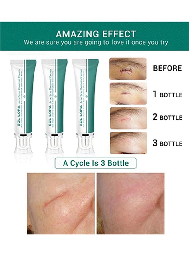 SOL LORA Acne Scar Removal Cream，Skin Repair Scar Remover & Acne Treatment & Fade Stretch Marks, Scar Erase ,Scar Removal Gel，Acne Scar Treatment，Deep Acne Scar Removal,Burns Keloids Hypertrophic, Repair Damaged Skin 30g - Image 5