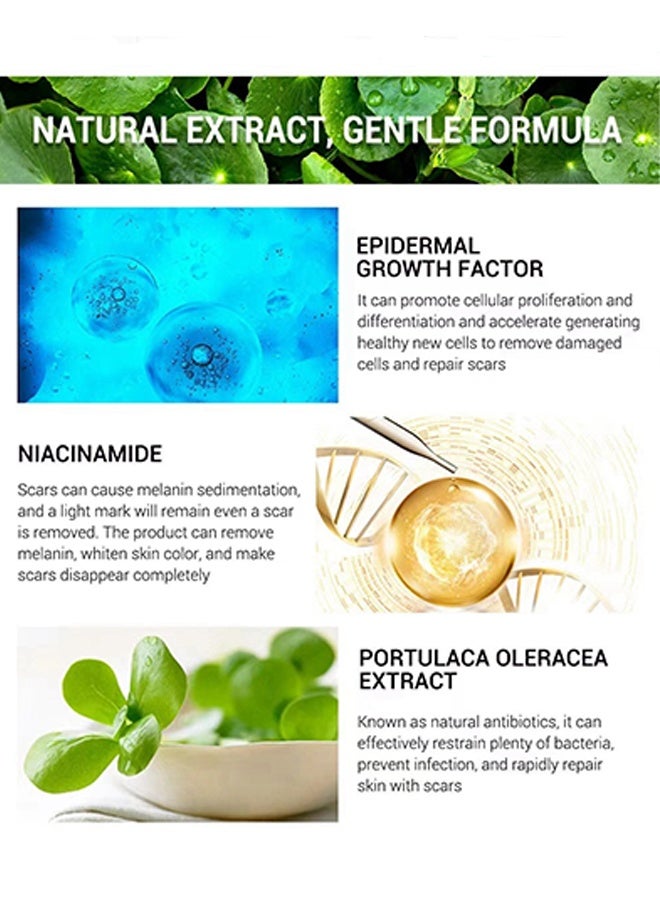 SOL LORA Acne Scar Removal Cream，Skin Repair Scar Remover & Acne Treatment & Fade Stretch Marks, Scar Erase ,Scar Removal Gel，Acne Scar Treatment，Deep Acne Scar Removal,Burns Keloids Hypertrophic, Repair Damaged Skin 30g - Image 3