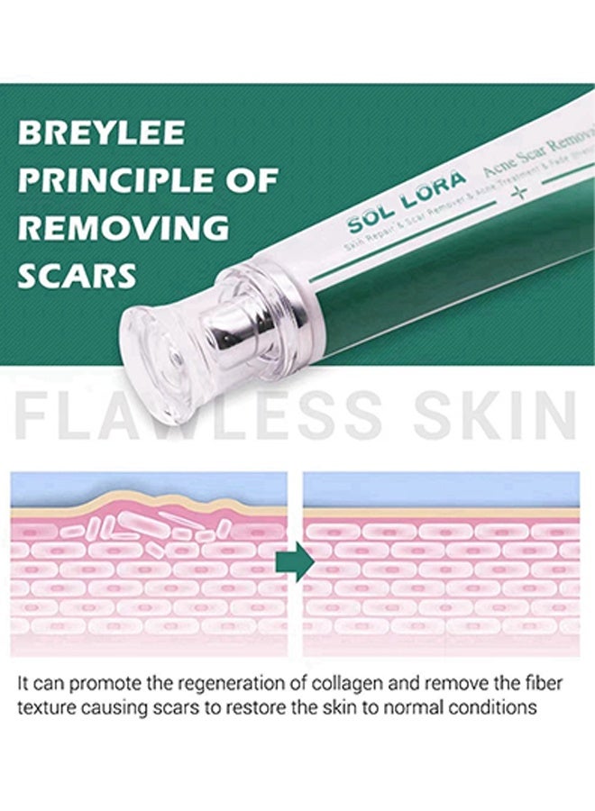 SOL LORA Acne Scar Removal Cream，Skin Repair Scar Remover & Acne Treatment & Fade Stretch Marks, Scar Erase ,Scar Removal Gel，Acne Scar Treatment，Deep Acne Scar Removal,Burns Keloids Hypertrophic, Repair Damaged Skin 30g - Image 4