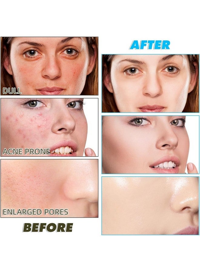 SIMXEN Kojic Acid and Turmeric Cleansing Pad - 60 Count, Mild and Non-Irritating Turmeric Kojic Acid Pads for Face, Suitable for All Skin Types, Gentle Exfoliating Facial Pads - Image 4