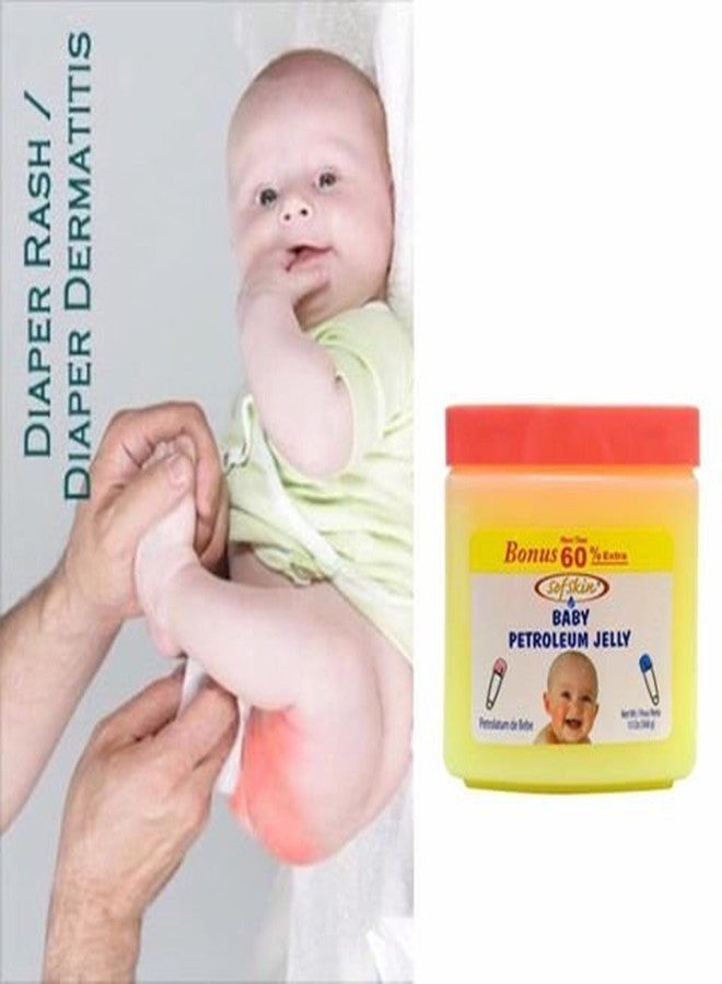 SOFSKIN (USA Brand) Baby Jelly (Perfumed), Skin Protectant and Moisturizer, 170 gm, Nursery Care for Diaper Rash, Sanitary Napkin Rash, Minor Cuts and Chapped Skin. Export Surplus. Paedratics recommended. (See Video) - Image 5