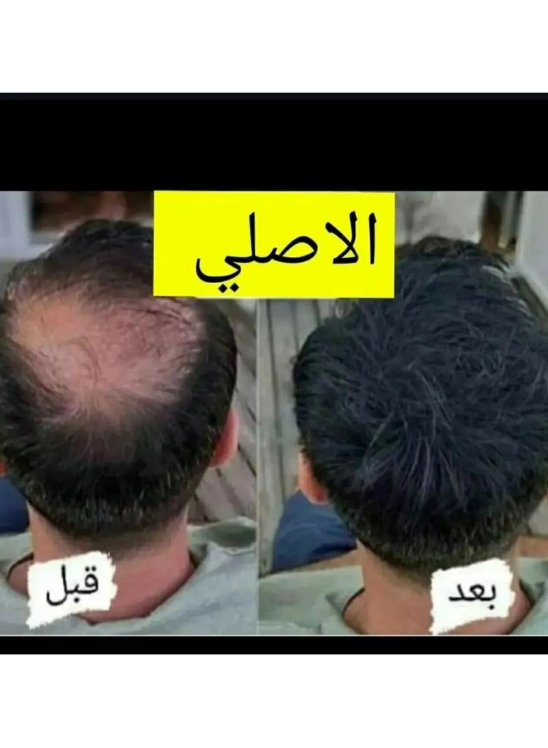 بروكسي سوفت بروكسي زيت شعر افغاني 125مل - Image 3