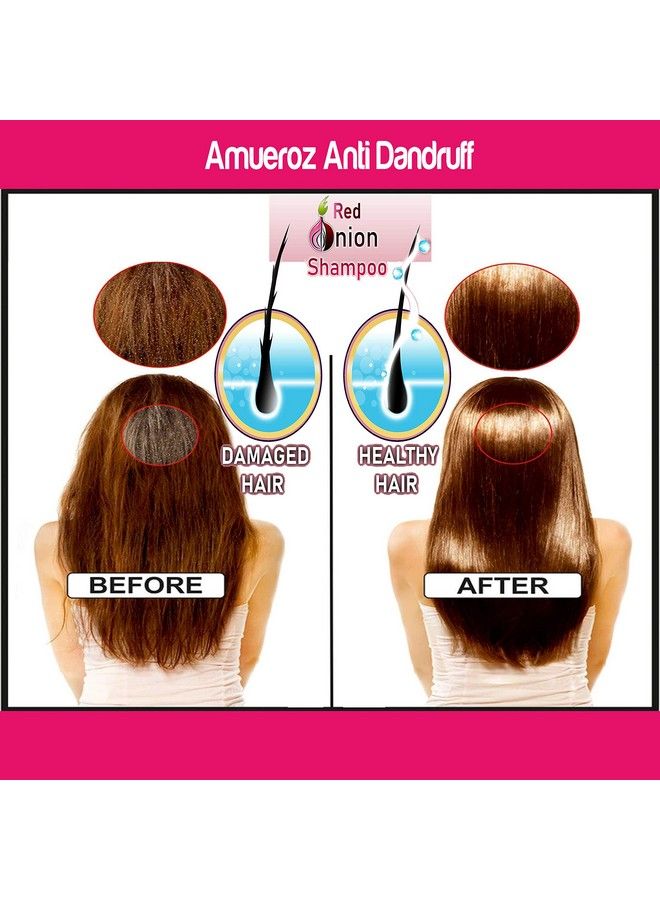 Amueroz Onion Shampoo For Hair Growth 200 Ml & Onion Black Seed Hair Oil For Hair Growth 60 Ml With Red Onion Extract And Essential Ingredients - Image 5