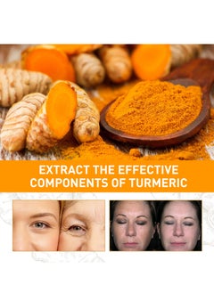 West&Month Turmeric Oil, Turmeric Dark Spot Correcting Serum Oil, Turmeric Repair Face Serum, Natural Turmeric Bright Skin Dark Spot Skin Care Moisturizing Repair Serum, Turmeric Oil for Face Dark Spots(10ml)  - Image 4